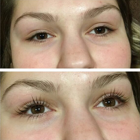 edmonton eyelash lift before and after